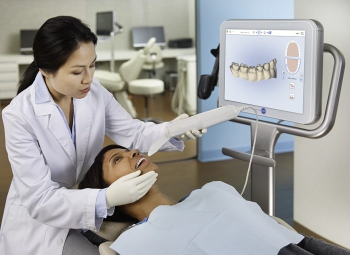 itero-scanner-ebbers-family-dental